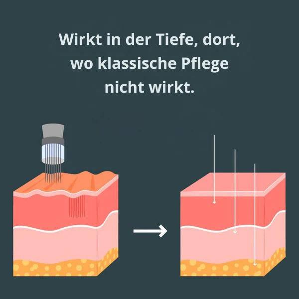Micro-Infusion Lift Pro + zusätzliches Serum gratis!